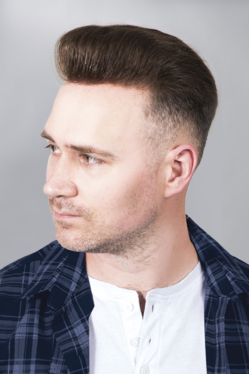 Hairline - Image 3