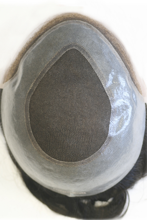 Hairline - Image 6